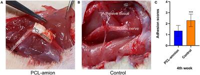 Electrospun Polycaprolactone (PCL)-Amnion Nanofibrous Membrane Promotes Nerve Regeneration and Prevents Fibrosis in a Rat Sciatic Nerve Transection Model